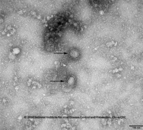 중국 우한 코로나바이러스 전자현미경 사진. <사진=질병관리본부>