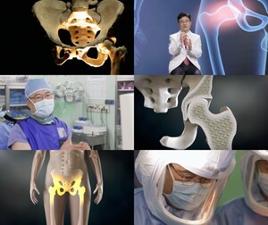 <b>EBS</b> '<b>명의</b>' <b>고관절</b> 질환 원인과 치료...전영수 교수